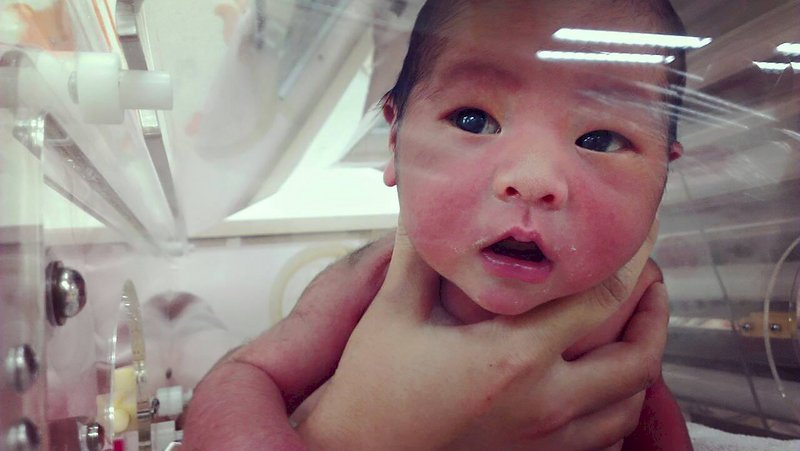 撫育2名未滿3歲子女 父母可同時請育嬰假