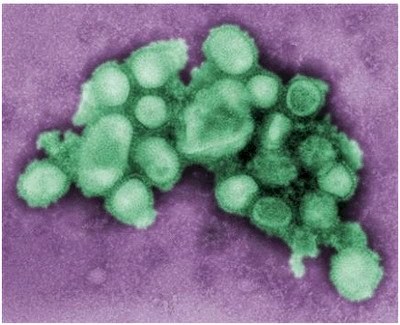 匈牙利確診 H1N1新流感致1死
