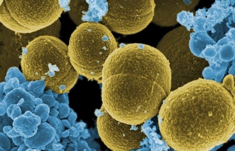 研究：超級細菌未來25年內恐致3900萬人死亡