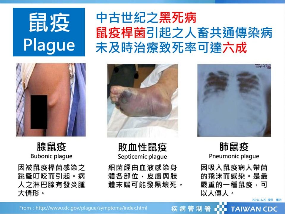 中國大陸鼠疫疫區廣 疾管署籲避免前往內蒙等高風險區