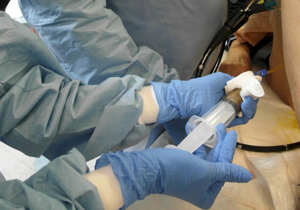糞便也能救人 種入腸道正常細菌成功拯救骨髓移植血癌病患